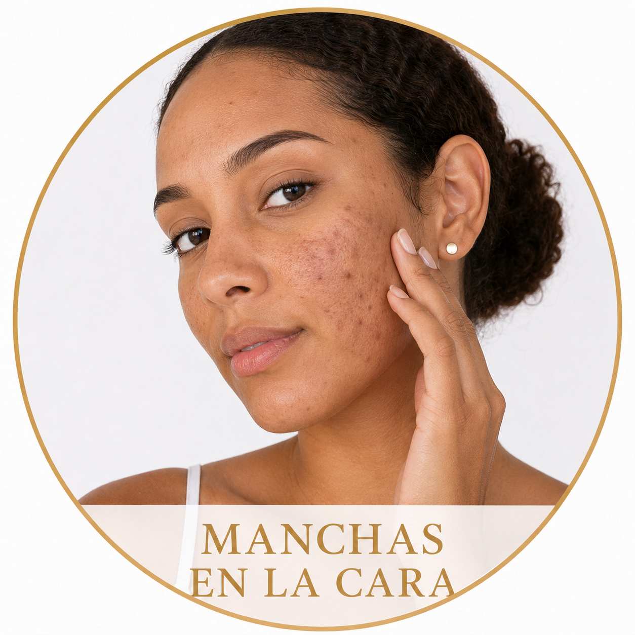 Manchas Faciales