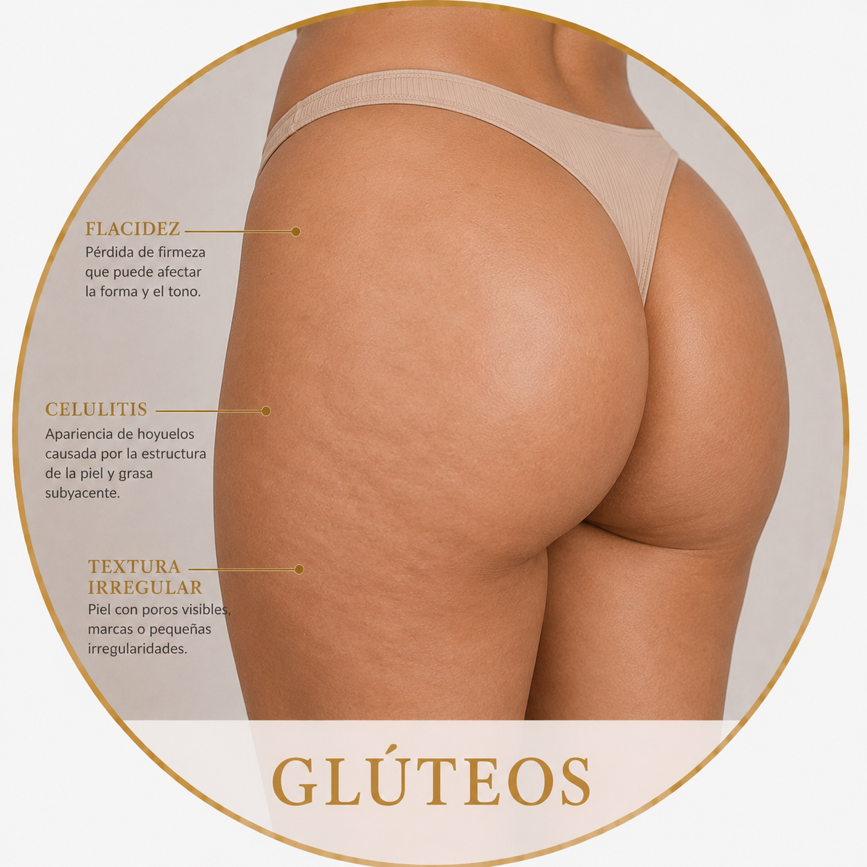 Glúteos