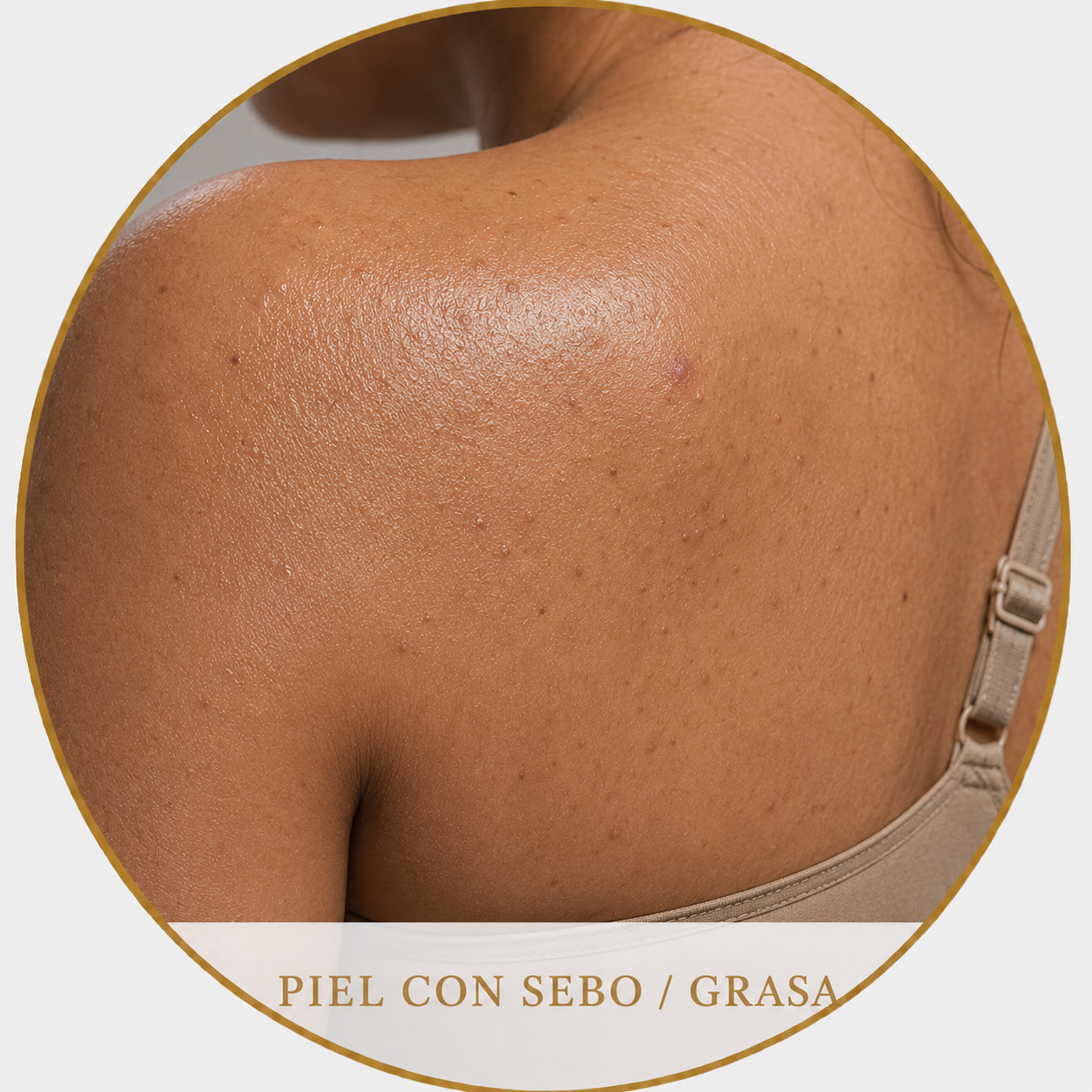 Piel son sebo y grasa